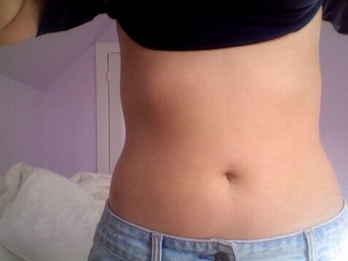 Efekt kuracji kapsułkami NEOflorax