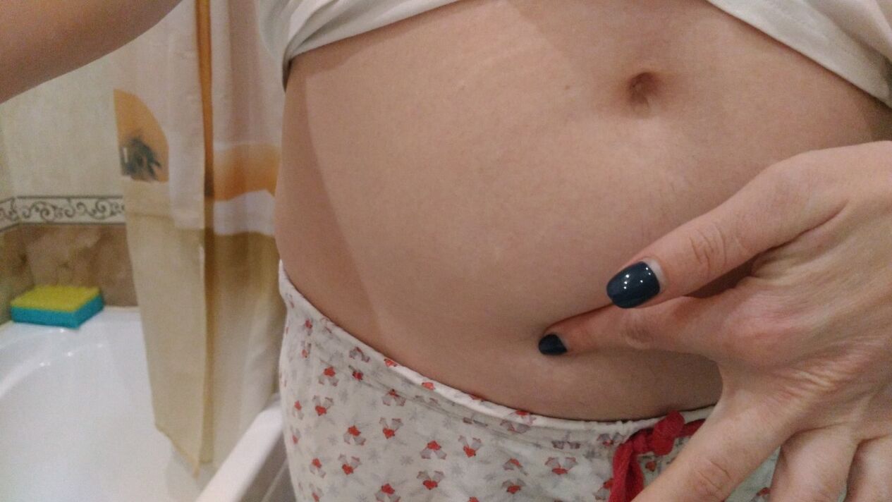 Oznaki infekcji robakami pasożytniczymi z własnego doświadczenia