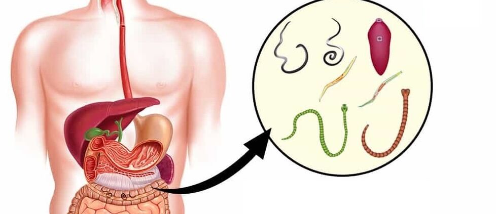 Pasożyty w organizmie człowieka