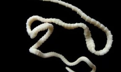 jak usunąć pasożyta cestode z organizmu