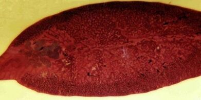 pasożyt przywrowy jak usunąć z organizmu